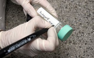 Найден метод по борьбе с раком простаты