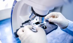 Миниатюрный микроскоп будет идентифицировать раковые клетки в реальном времени