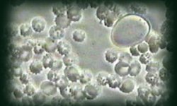 Микоплазмоз
