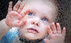 Миниатюрные мозги, изготовленные из клеток кожи пациентов, помогут понять аутизм