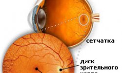 Макулит