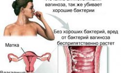 Гарднереллез