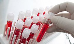 Учеными был придуман тест лихорадки Эбола, проводимый за несколько минут