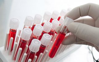 Учеными был придуман тест лихорадки Эбола, проводимый за несколько минут