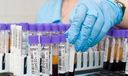 Норвежские исследователи разрабатывают уникальное устройство для мгновенного анализа крови