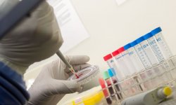 В Бразилии утвердили вакцину против лихорадки денге