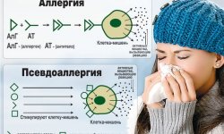 Ложная аллергия