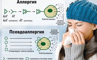 Ложная аллергия
