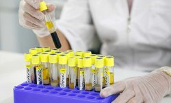 Ученые определили гены, отвечающие за длительность человеческой жизни