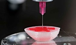 Благодаря 3D-печати ребенку безопасно пересадили почку взрослого человека