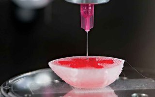 Благодаря 3D-печати ребенку безопасно пересадили почку взрослого человека