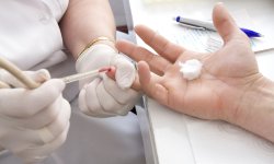 Изобретен экстренный тест для определения группы крови
