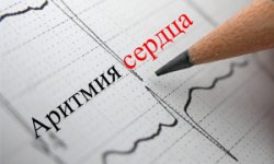 Аритмия