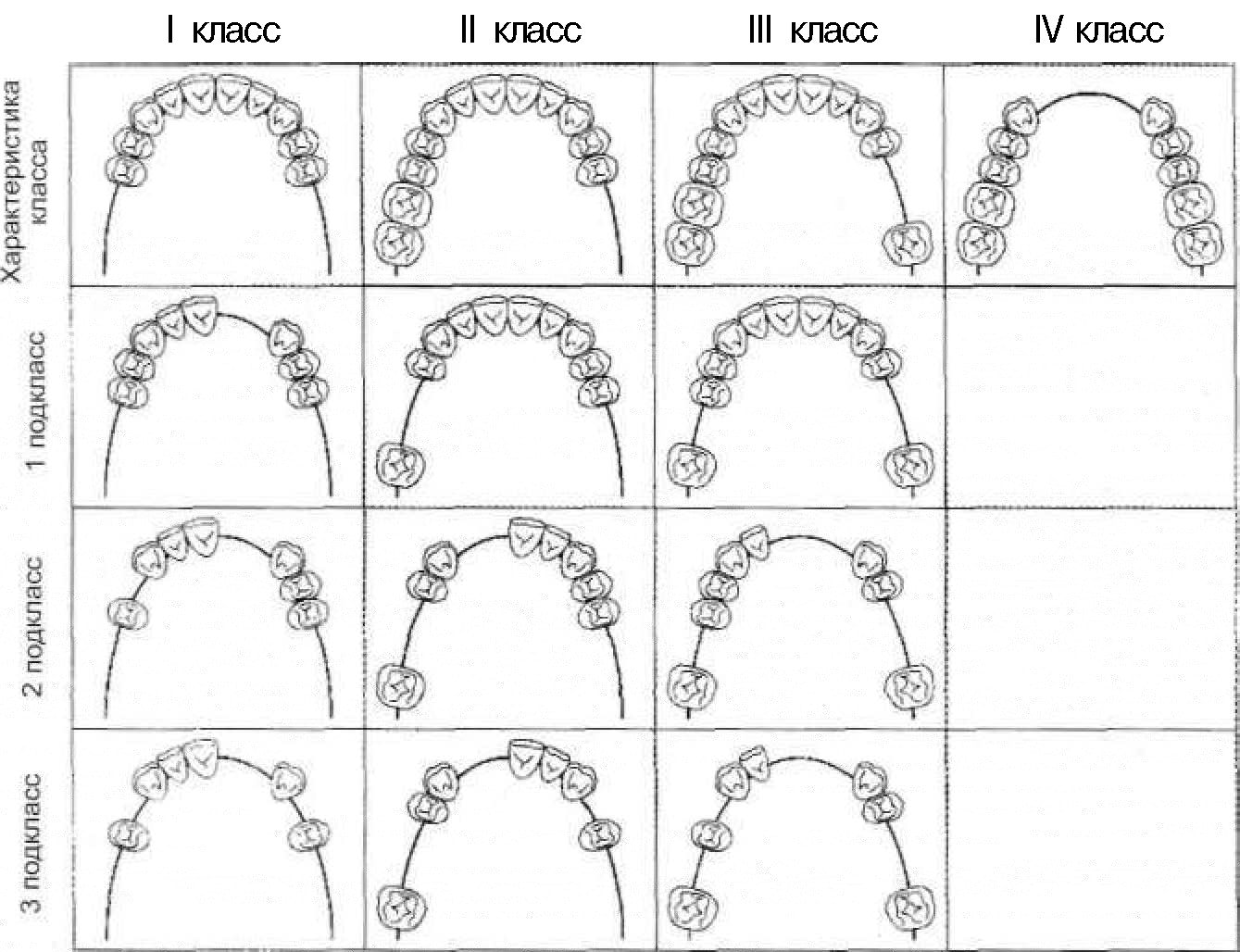 Дефекты зубных рядов