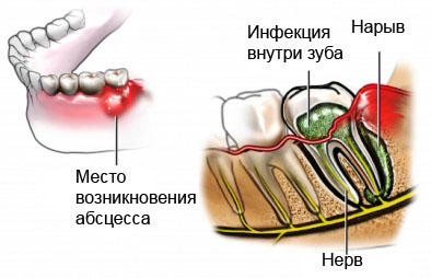 Флюс