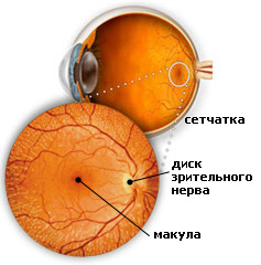 Макулит