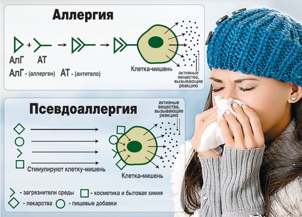 Псевдоаллергия