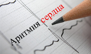 Аритмия сердца