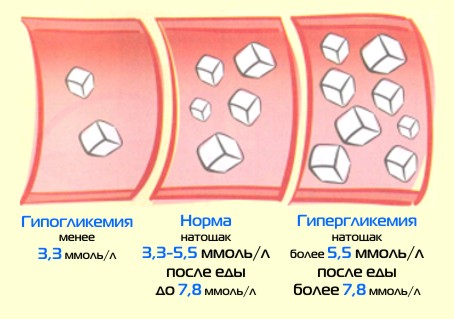 Гипогликемия